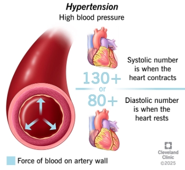 What Is Blood Pressure?